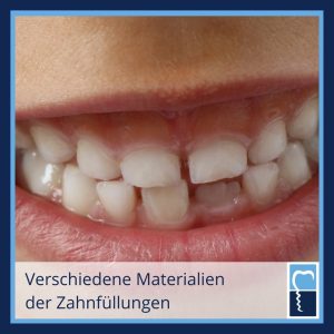 Zahnarzt Lauf Zahnfüllungen Dr Petschelt